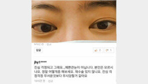서유리, 눈 성형 의혹에 “그레이브스병으로 안구돌출” 해명