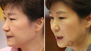 세월호 전날엔 없었는데… 6일뒤 주사 자국?