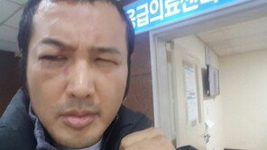 ‘안구함몰’ 김보성, 수술 포기 “오른쪽 눈마저 실명될 수 있어”