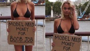  ‘가슴 수술 비용’ 모금 비키니 美女, 알고 보니…‘실험영상’