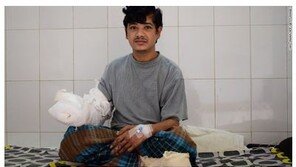 방글라데시 ‘나무 인간’ 16차례 수술로 양손 회복…“딸 안을 수 있다”