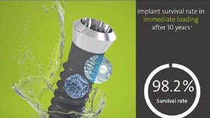 [헬스동아]치료기간 획기적으로 단축시킨 임플란트