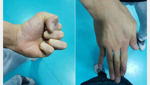 삼성화재 박철우의 휘어진 손가락은 뜨거움이다