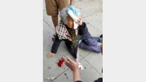 재미교포 할머니, 대낮에 백인 여성에 피습…美 우선주의 영향?