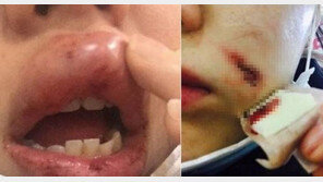 “20cm 돌로, 두 여성 무차별 폭행”…‘궁금한 이야기 Y’ 집중 조명 