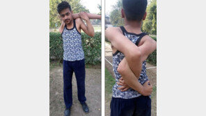 [영상]헉! 팔이 360도 돌아가는 소년?…“너무 재미있다”