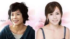 신이, 양악수술 전후 사진 보니…‘헉’