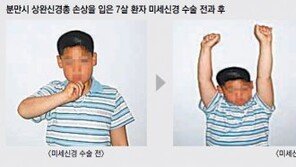 [헬스동아]중풍, 뇌졸중으로 마비된 팔-다리… 미세신경 수술로 완화 가능