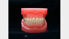 치과의원 폐업, 先지급 교정치료비 못돌려받는 피해 잇따라