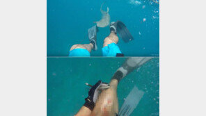 [영상]작살 사냥하다 사냥 당할뻔한 男? 상어에 다리 물어뜯겨…