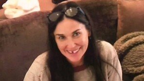 앞니 ‘쏙’ 빠진 모습 공개한 유명 女배우, “스트레스 심해”