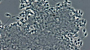 “불임-피임, 남성의 몸도 알아야죠”
