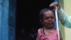 5세 때 성장 멈춘 男, “작은 키(74cm) 문제 안 돼…할 건 다 해요”