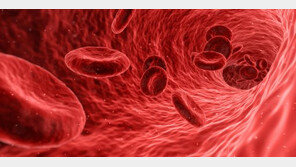 [헬스동아]수혈 아닌 철분주사제로 ‘빈혈’ 안전하게 치료하세요 