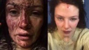 데이트 중 음주운전 말리는 여자친구 폭력…피투성이로 창밖에 손내밀어 발견