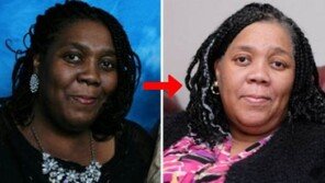 OO약 복용 6개월 만에 ‘검은 피부’ → ‘하얀 피부’…희귀 부작용