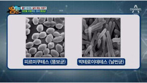 똑같이 먹었는데 왜 나만 살찌나 했더니…“뚱보균 많기 때문”