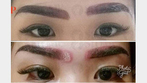 ‘무허가’ 눈썹 문신 시술 받은 女, 거울 보고 기겁…“이거 정말 실화냐?”