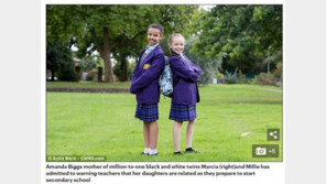 “친자매 맞아? 처음엔 놀라지만…” 1/100만 확률 ‘흑백 쌍둥이’자매 근황