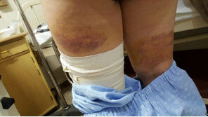 충남 아산서도 여중생 감금폭행, 성매매 강요까지…