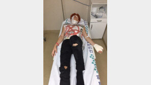 유키스 기섭, 폭발사고로 2도 화상…“이 상황에 굳이 사진은 왜” “구경거리 났나”