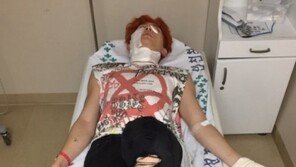 ‘2도 화상’ 유키스 기섭 “걱정·심려 끼쳐 죄송하다”…현재 상태는?