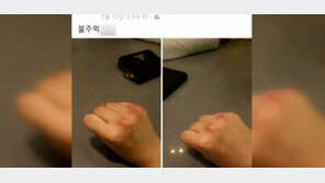 서울서도 여중생 집단폭행…가해자, 때리다 멍든 손 사진 올리며 “불주먹”