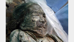 400년전 조선시대 여성 미라, 사망원인은 ‘성인병’