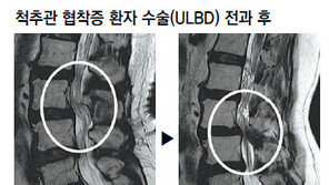 [헬스동아]간편-정확한 고주파로 ‘허리 통증’ ‘다리 땅김’ 말끔히 해결