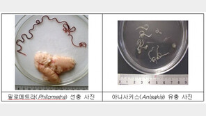 학교 급식서 나온 ‘고래회충’…“위장벽 관통해 복막염 유발까지”