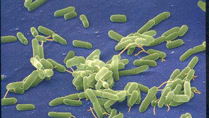 한일관 대표 사망 유발 ‘녹농균’, 어떤 균이기에…음식점 물티슈에도 존재? 