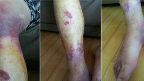 [국감]부산대병원장, ‘교수 폭행 사건’ 질타에 “참담하고 있을 수 없는 일”