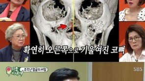 이상민, 얼굴에 철심 박은 이유…“남희석 도우려다 전치 8주 폭행 당해” 