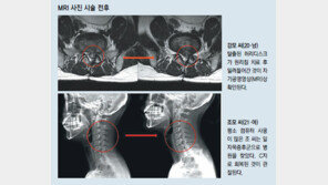 [헬스동아]수능 끝낸 수험생들, 목-허리 통증부터 잡으세요