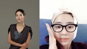 윤현숙, 양악수술 왜 했을까?…“2012년, 턱관절 고통 때문”