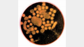 평창올림픽 앞두고 노로바이러스 비상…대표적 증상은?
