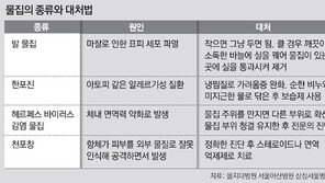 “물집 생기면 터뜨리지 말고 기다리세요”
