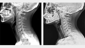 스마트폰 사용시 눈높이-거리 조절을…
