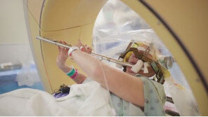 [영상]뇌수술 중 깨어있는 상태로 플루트 연주, 일부러 한 거라고?