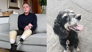 애견에 살짝 물린 상처 방치한 결과→두 다리·다섯 손가락 절단…왜?