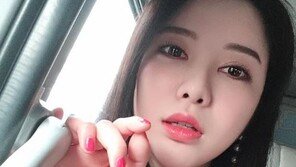 가수 신나라 교통사고…“타박상, 안정 취하는 中”