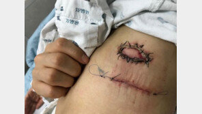 한예슬, 수술받은 ‘지방종’이란? …왜 성형외과 아닌 일반외과에서?