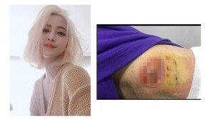 ‘한예슬 지방종 의료사고’ 응원 쇄도…“연예인이라 공론화” “이번에 바꾸자” 