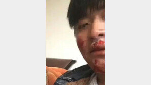 애꿎은 원숭이 괴롭힌 男, 보복 공격에 얼굴 엉망 …자업자득