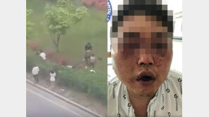 광주 폭행, 피해자 ‘실명 위기’·가해자 7명, 조폭 연루설…경찰 입장은?
