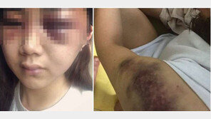 광주 데이트폭력 “넌 내 장난감, 그냥 죽으면 재미 없어” 보온병으로 머리 가격