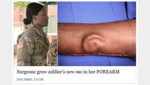 교통사고로 왼쪽 귀 잃은 여군, 팔뚝서 ‘귀 배양’…곧 새 귀 이식