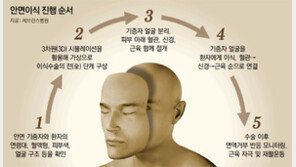 국내서도 ‘안면이식’ 가능해진다