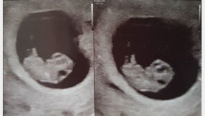 윤상현♥메이비, 초음파 사진 공개…“축복입니다. 소중한 우리 셋째”