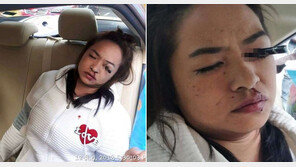 택시서 눈 화장 20대 女, 추돌사고로 눈에 아이라이너 박히는 ‘참변’